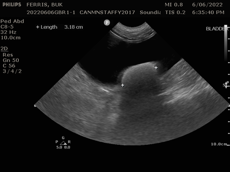 Hematuria due to bladder cystolith and something else…