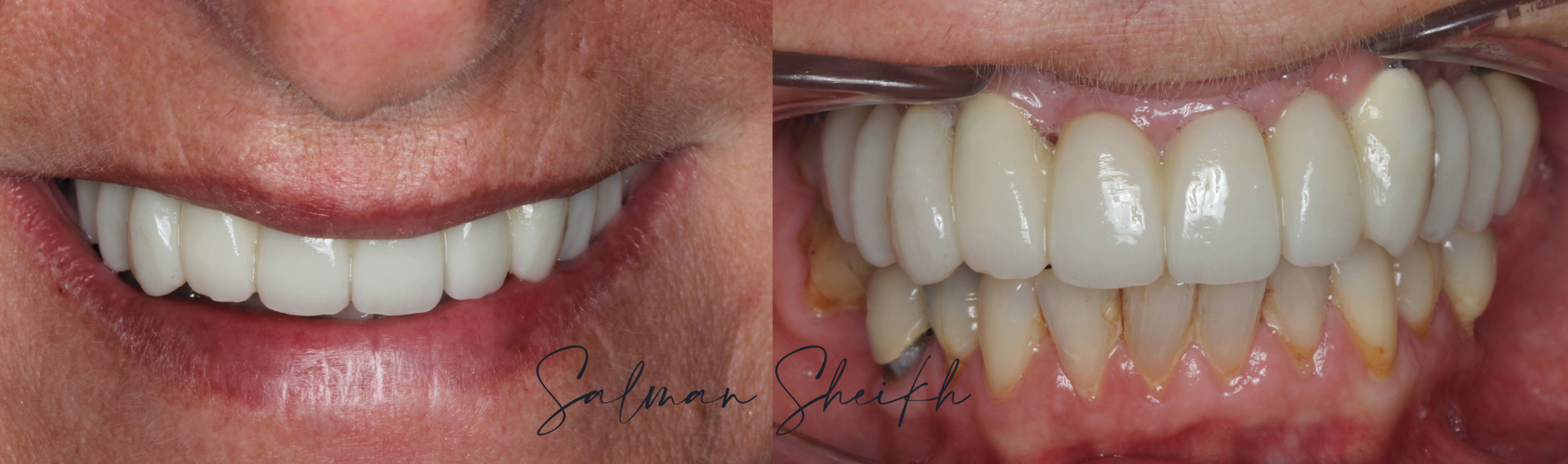 Dr Salman Sheikh - Implantology