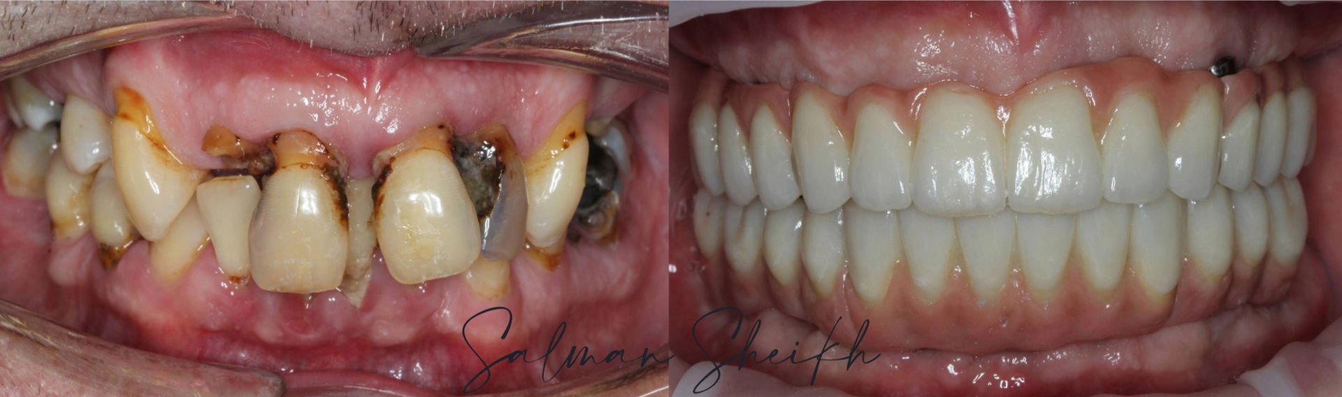 Dr Salman Sheikh - Implantology