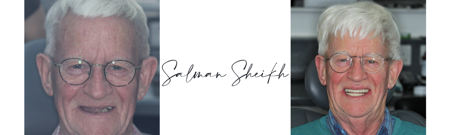 Dr Salman Sheikh - Implantology