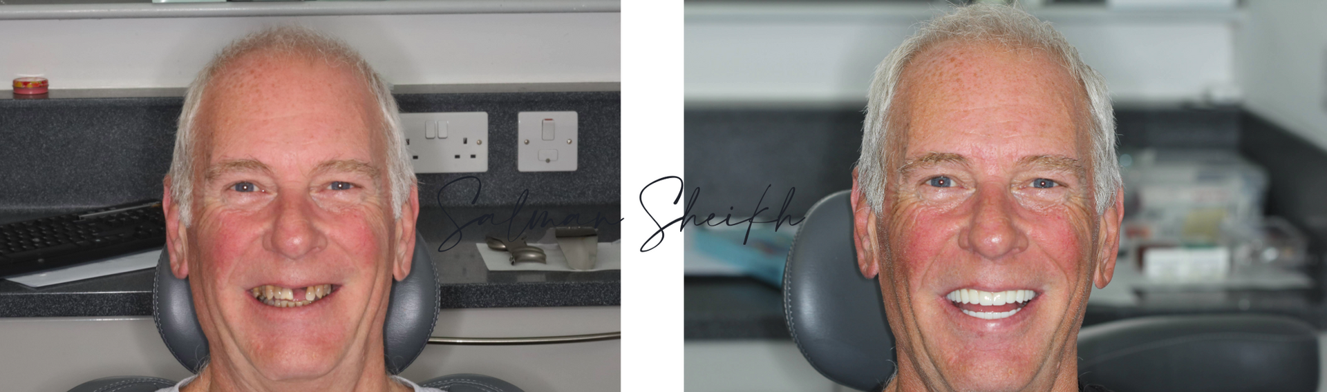 Dr Salman Sheikh - Implantology