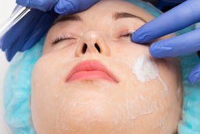 The Power of Chemical Peels: Restoring Radiance and Rejuvenating Your Skin