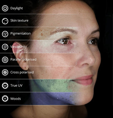Skin analysis