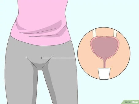 EJERCICIOS DE KEGEL
