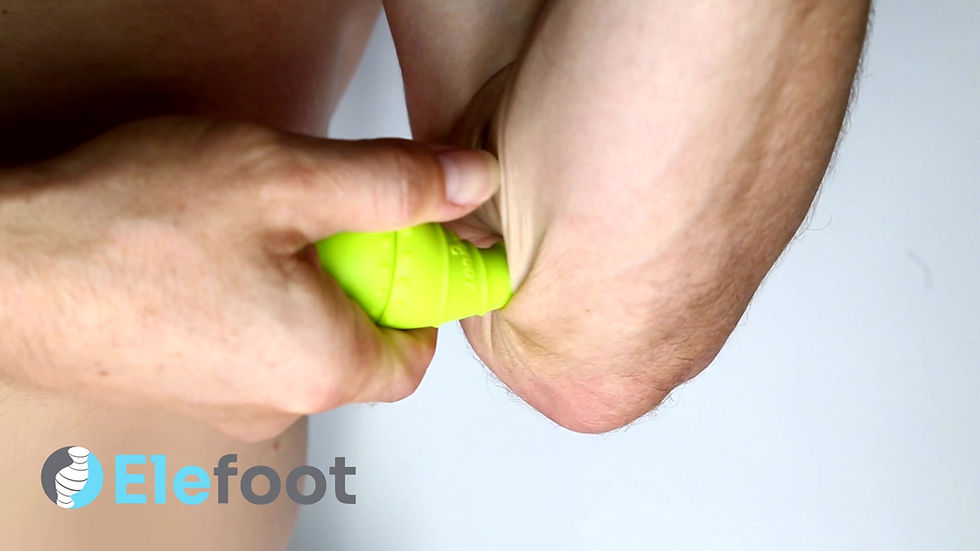 Thumbnail: Elefoot