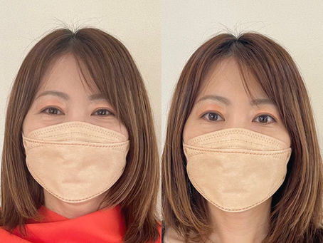 骨格ミックスは幅が広がる場合も