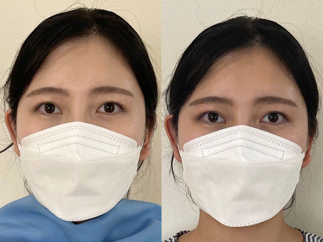 ブルベさんの透明感あり