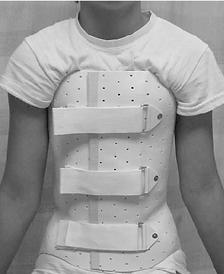 The-Wilmington-brace-is-a-popular-thorac