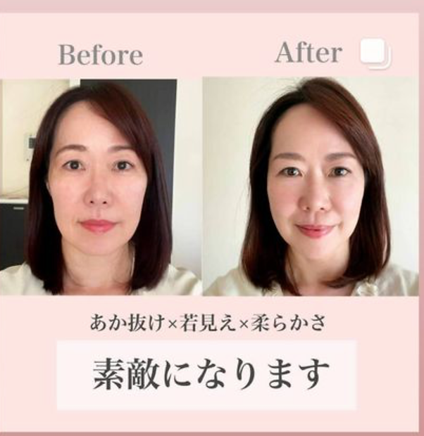 898BAA38-8FDA-4D78-8518-855D9344D7F3.png