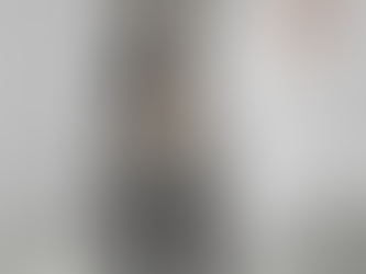 ESERCIZI IPERLORDOSI LOMBARE: COME MIGLIORARE POSTURA E RIDURRE DOLORE