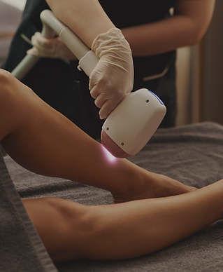 Epilation Laser.png
