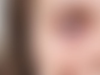 Coceira nos olhos