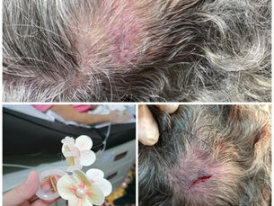 cuidado con accesorios