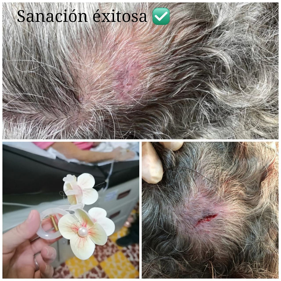 cuidado con accesorios
