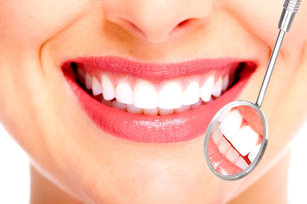 ホワイトニング