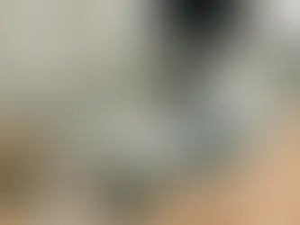 ¿Qué son las várices y por qué aparecen?
