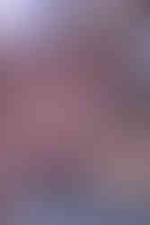 advanced esthetics massage treatment for facial sculpting