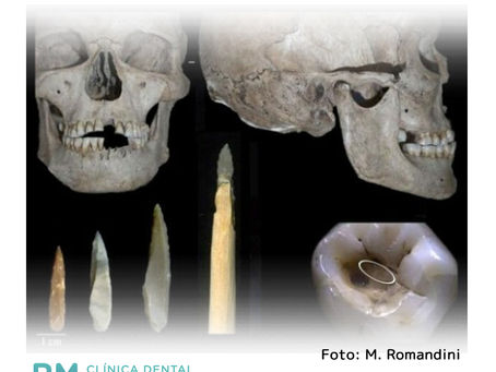 Así eran los dentistas de hace 14.000 años