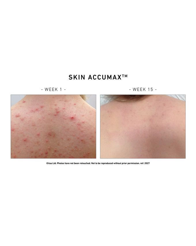 Thumbnail: Skin Accumax - 180 capsules