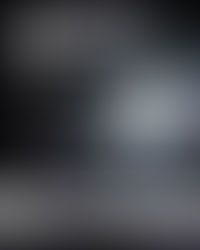 Guida notturna difficile? A Ferrara arrivano le nuove lenti NITIDA® anti-abbagliamento