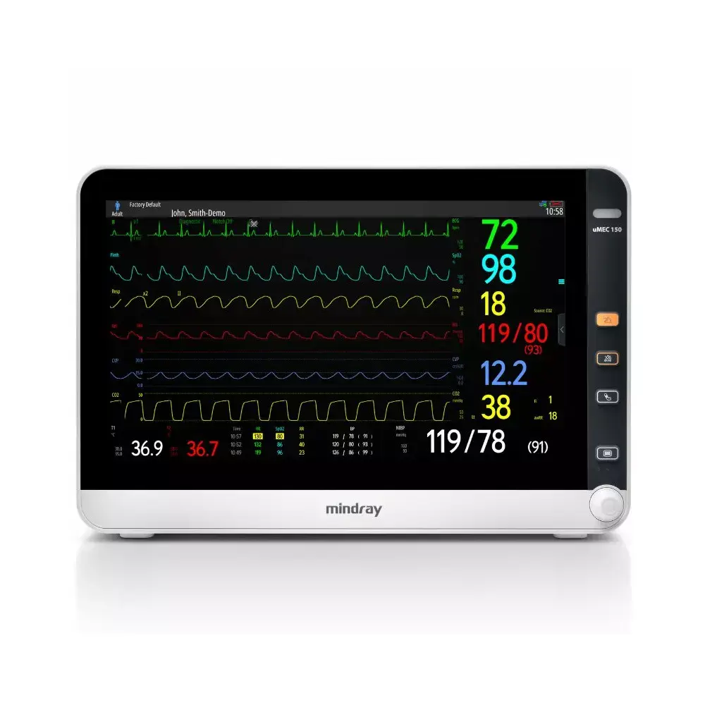 Mindray uMEC 150 Patient Monitor