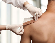 Taping a shoulder wound
