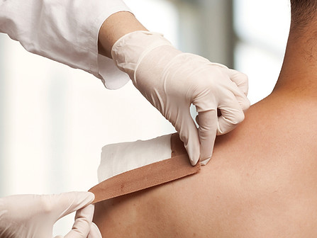 Applying medical bandage