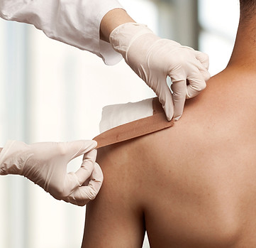 Taping a shoulder wound