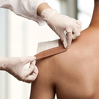 Taping a shoulder wound