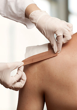 Applying Shoulder Bandage