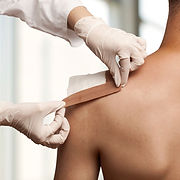 L'enregistrement d'une blessure à l'épaule