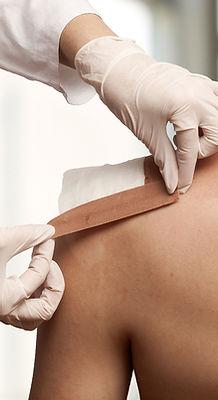 Taping a shoulder wound