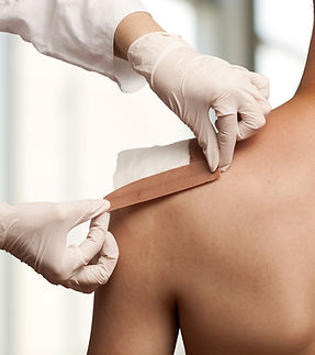 Anlegen eines Schulterverbandes