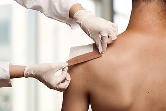Taping a shoulder wound