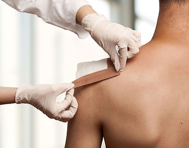 Blessure musculaire traitée par la médecine chinoise