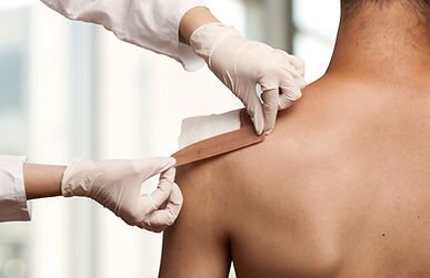 Taping a shoulder wound