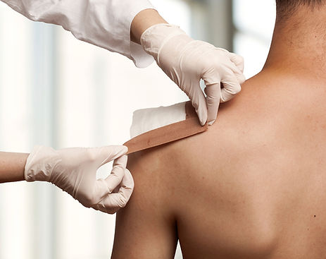 Taping a shoulder wound