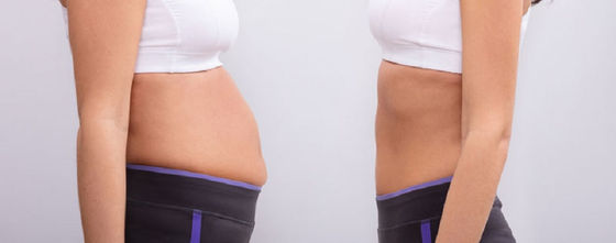 Frequently asked questions about abdominoplasty