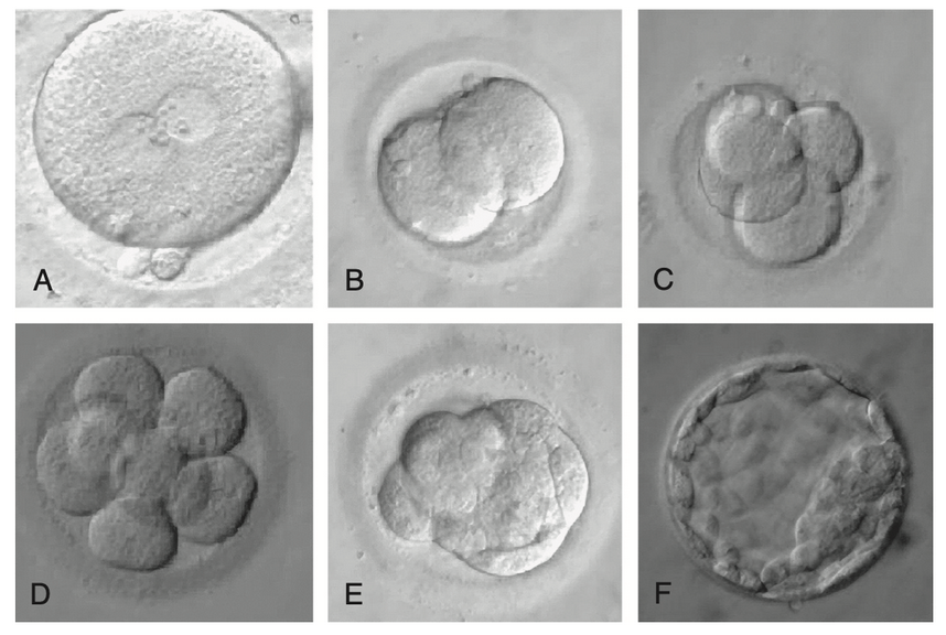 Did You Know? Your Eggs Have “Grades” Too! — Understanding GV, MI, and MII Stages