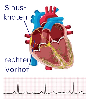 Sinusrhythmus