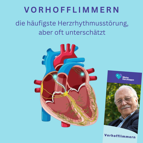Vorhofflimmern – die häufigste Herzrhythmusstörung, aber oft unterschätzt