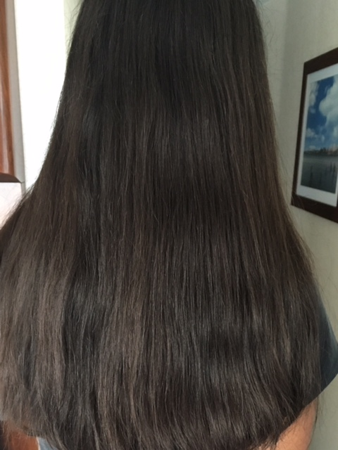 Telogen effluvium: Sudden Rapid Hair Loss