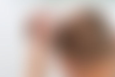 Top 5 Questions Men Ask Before Getting a Hair Transplant