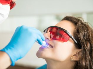 The Truth About Teeth Whitening