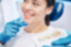 Dental Veneers Zirconium4.jpg