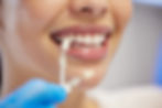 Dental Veneers Zirconium3.jpg