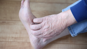 Hautausschläge an den Füßen scheinen ein Symptom für Covid-19 zu sein