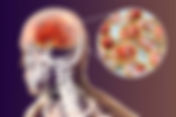 Invasive meningococcal disease among Umrah pilgrims: The need for vaccination, Center for Disease Control and Prevention,