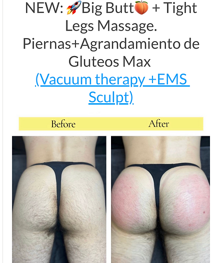 BODY SCULPTING bbl-butt-lift-body-contouring