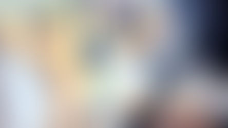 Candela laser hair removal treatment for men at Alexspot24 Miami Brickell